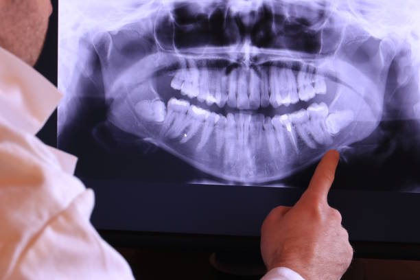 Best Emergency Root Canal Treatment in Harper, KS