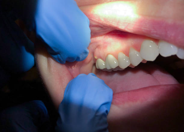 Best Emergency Root Canal Treatment in Harper, KS