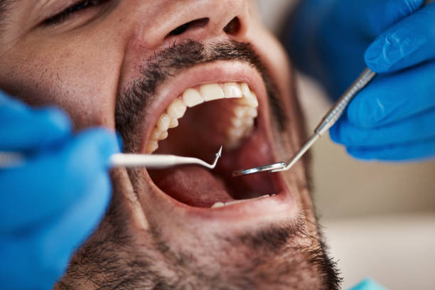 Best Emergency Treatment for Toothache in Harper, KS
