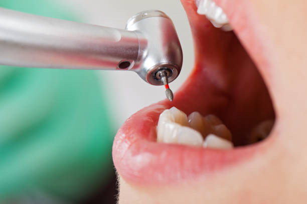 Best Walk-In Emergency Dentist in Harper, KS